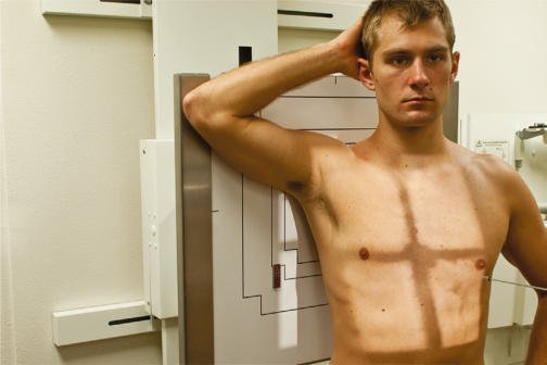 Fig. 10.39 RPO—injury la drept posterior Coaste (Grilaj Costal), above cupole diafragmatice.