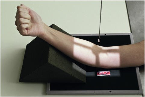 Fig. 4.125 AP Cot (partially flectat); Humerus paralel cu receptorul de imagine.