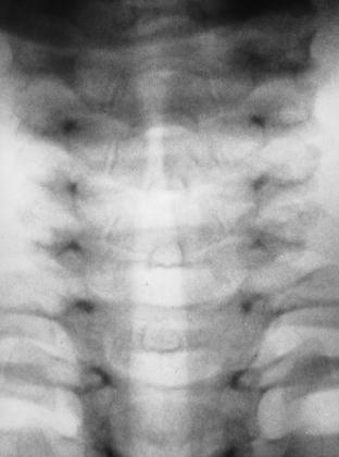 Figura 3