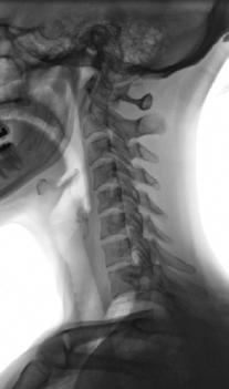 Fig. 2.87 Profil—superior