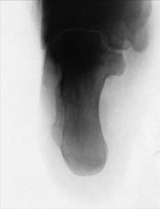 Fig. 6.79 Dorsoplantar (axial) weight-