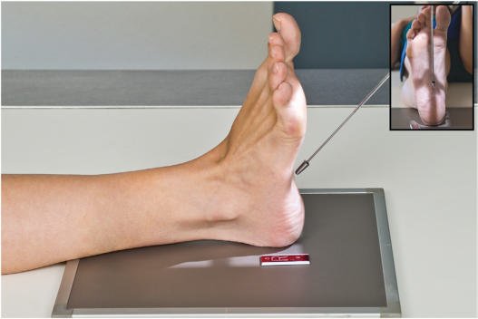 Fig. 6.72 Plantodorsal (axial) incidență de Calcaneu.