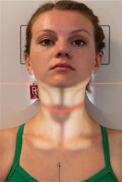 Fig. 8.50 AP axială, unghi cranial de 15°.