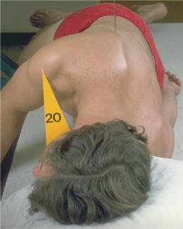 Fig. 8.86 oblic posterior