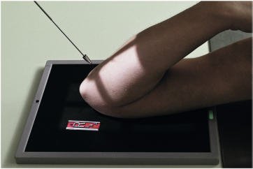 Fig. 4.130 pentru proximal Antebraț—Raza centrală perpendiculară la Antebraț.