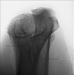 Fig. 4.134 proximal Antebraț.