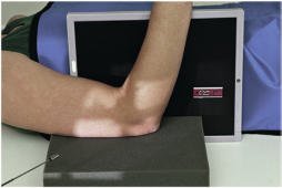 Fig. 4.149 Decubit dorsal, înclinat 45° pentru