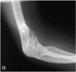 Fig. 4.152 axial lateromedial