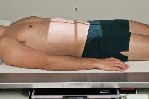 Fig. 3.28 Abdomen AP (KUB).