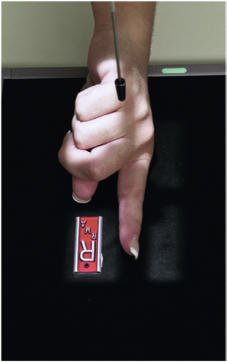 Fig. 4.45 Second falange