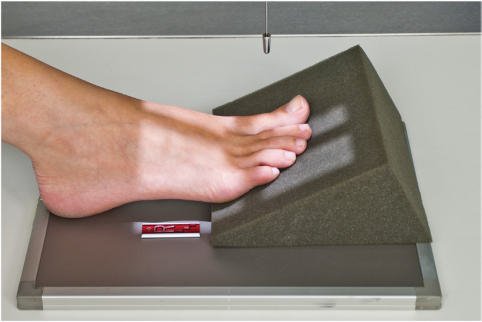 Fig. 6.40 AP second falange cu wedge (Raza centrală perpendiculară).