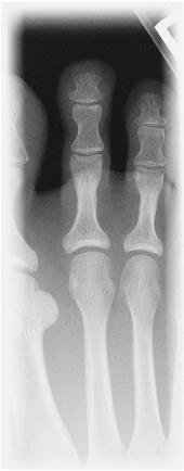 Fig. 6.41 AP second