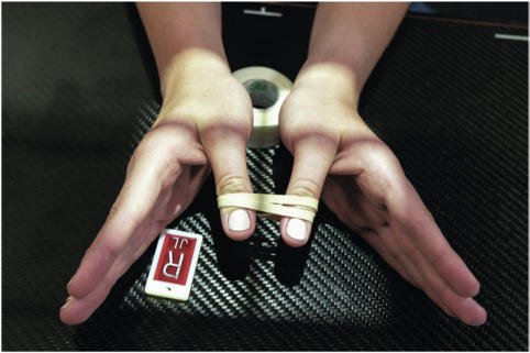 Fig. 4.64 PA stress incidență de bilateral thumbs; Raza centrală perpendiculară la