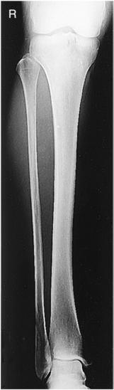 Fig. 6.99 AP Gambă—