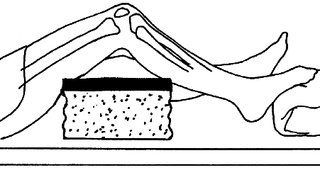 Fig. 6.128 8 × 10 inches (18 × 24 cm) receptorul de imagine.