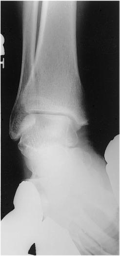 Fig. 6.96 Inversion stress.