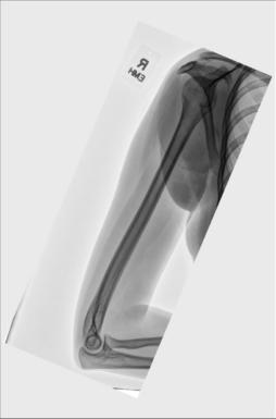 Fig. 5.32 și also Fig. 5.33).