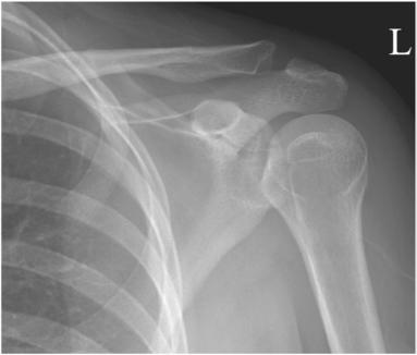 Fig. 5.44 intern rotație—lateral. (Courtesy Joss Wertz, DO.)