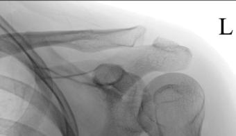 Fig. 5.45 intern rotație—lateral. (Courtesy Joss Wertz, DO.)
