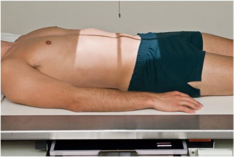 Fig. 14.71 IVU: radiografie preliminară și serie de radiografii.