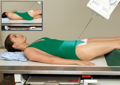 Fig. 13.84 AP axial—raza centrală înclinată 30° la 40° cranial. În casetă, LPO la 30° la 40°.