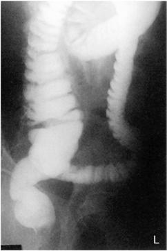 Fig. 13.64 RAO (centrat superior la