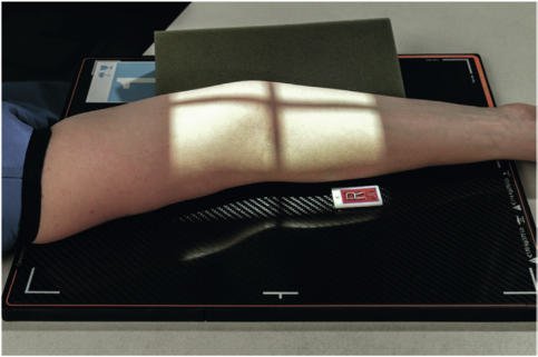 Fig. 4.135 45° lateral (extern) oblic.
