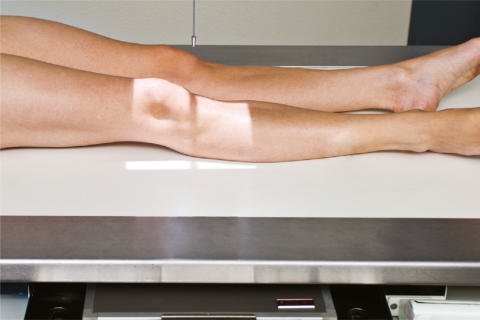 Fig. 6.110 AP lateral oblic. (Courtesy Joss Wertz, DO.)