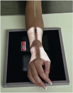 Fig. 4.91 PA oblic Pumn (Articulație Radiocarpiană) fără support.