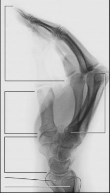 Fig. 4.82 lateral în flexion.