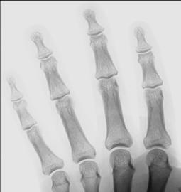 Fig. 4.84 AP axial. (de la Wilson DJ et al: Musculoskeletal imaging,