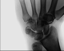 Fig. 4.85 AP axial. (Modified de la Wilson DJ et al: Musculoskeletal
