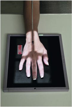 Fig. 4.67 PA Mână, raza centrală la treia articulație metacarpofalangiană (MCP 3).