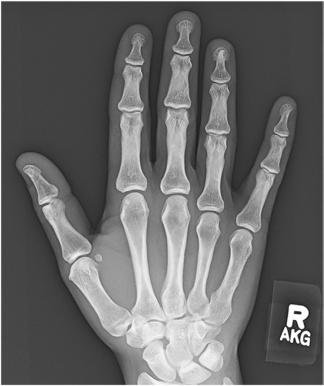 Fig. 4.68 PA Mână.