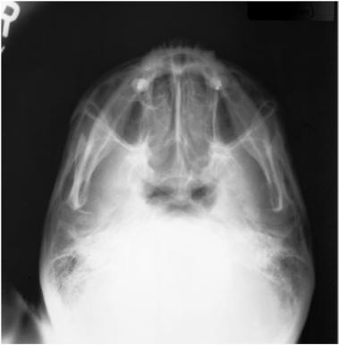 Fig. 11.168 SMV—Mandibulă.