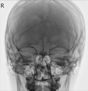 Figura 4