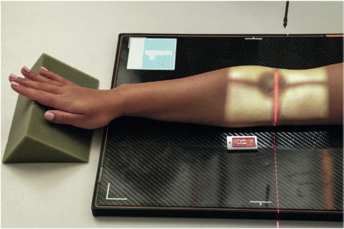 Fig. 4.139 medial (intern rotație) oblic.