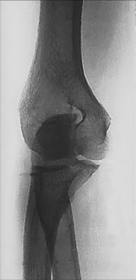 Fig. 4.142 medial oblic de drept Cot.