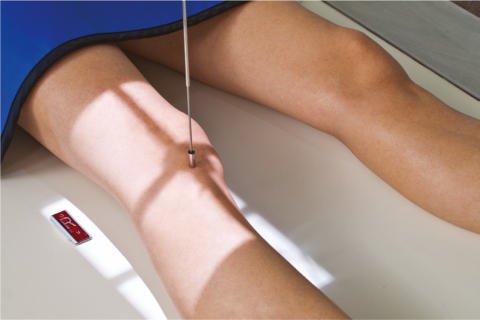 Fig. 6.106 AP 45° medial oblic.