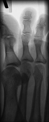 Fig. 6.45 medial