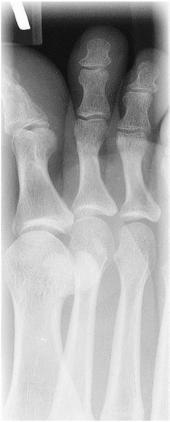 Fig. 6.46 medial oblic—