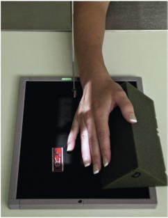 Fig. 4.40 Second falange (rotație internă (medială)).