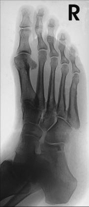 Fig. 6.62 40° medial
