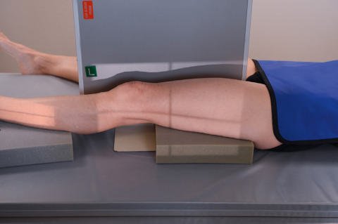 Fig. 7.39 traumatism acuttism / Regim Urgență lateromedial (orizontal fascicul) incidență.