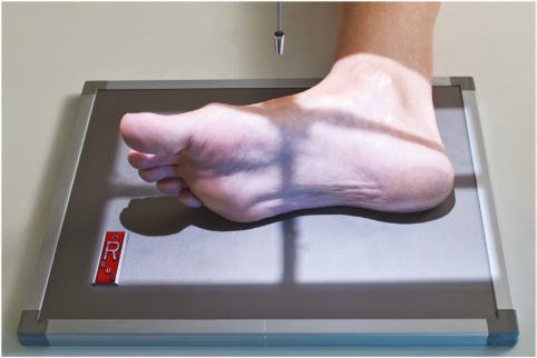 Fig. 6.63 Mediolateral incidență.