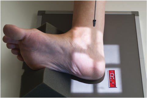 Fig. 6.75 Mediolateral Calcaneu.