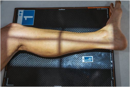 Fig. 6.101 Mediolateral Gambă—include ambele articulații.