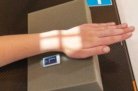 Fig. 4.102 PA Pumn (Articulație Radiocarpiană) pentru scaphoid ca follows: Mână ridicat 20°; ulnar