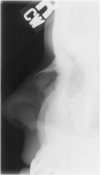Figura 3