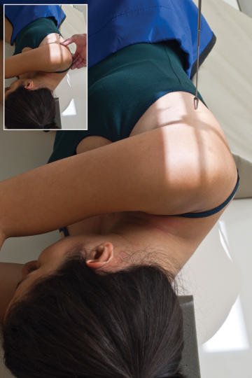 Fig. 5.106 Decubit lateral Omoplat (Scapulă) poziție. Inset shows palpating